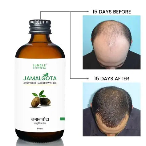 Jamalghota Hair Growth Oil Each 30ml Pack of 2